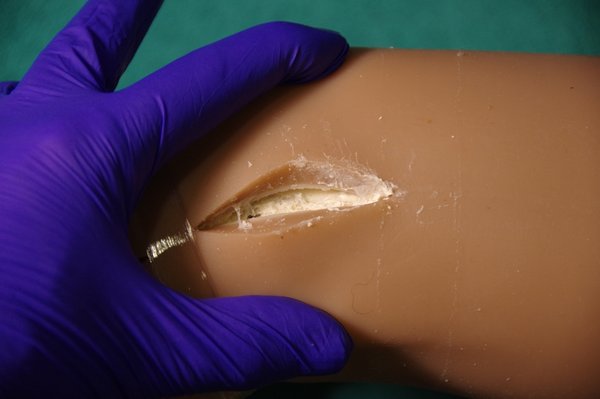 Lila Knee Repair (74).JPG