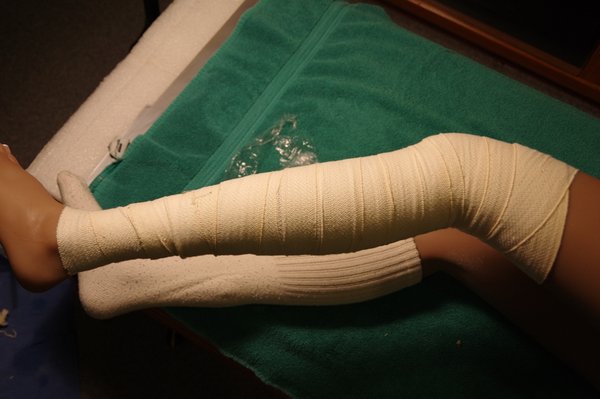 Lila Knee Repair (76).JPG