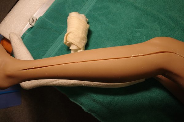 Lila Knee Repair (77).JPG