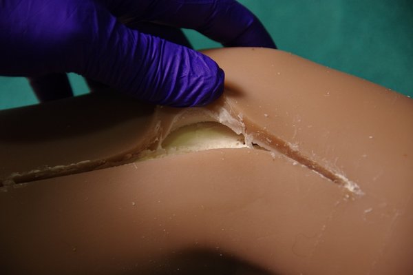 Lila Knee Repair (79).JPG