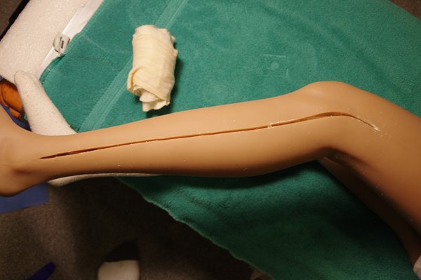 Lila Knee Repair (80).JPG