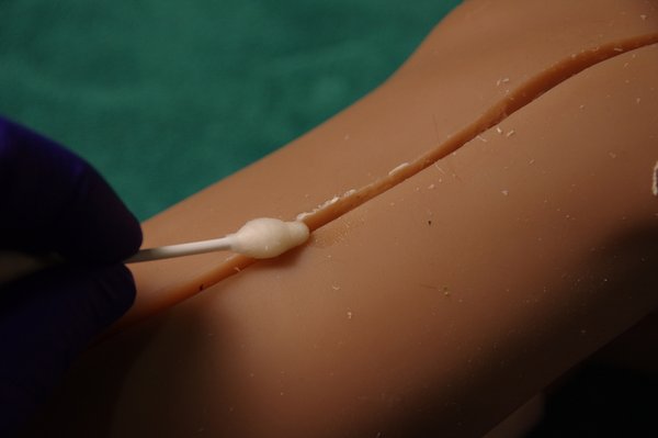 Lila Knee Repair (82).JPG