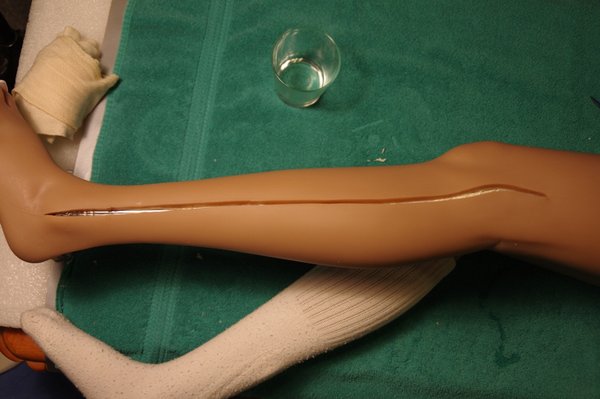 Lila Knee Repair (84).JPG