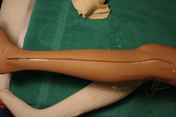 Lila Knee Repair (88).JPG