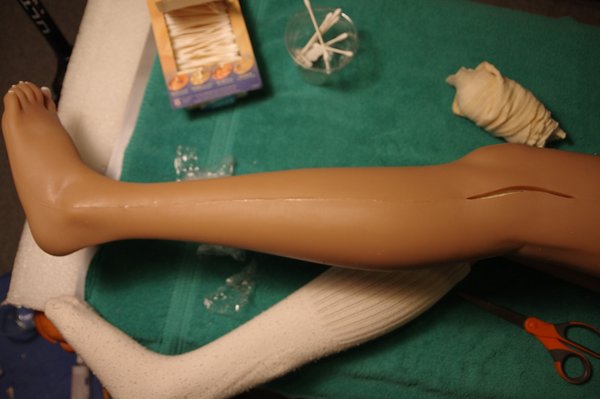 Lila Knee Repair (94).JPG