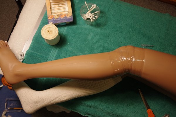 Lila Knee Repair (97).JPG