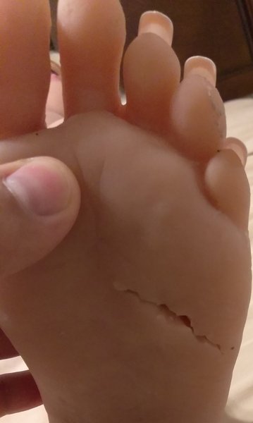 Left and right feet ripped at same spot
