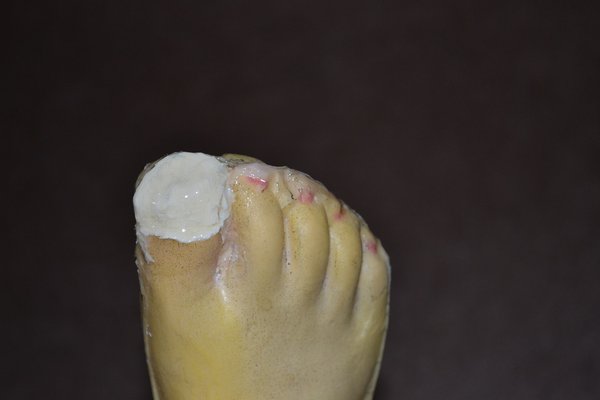 Right foot after gluing seam, trimming and covering big toe (w/liquid latex).