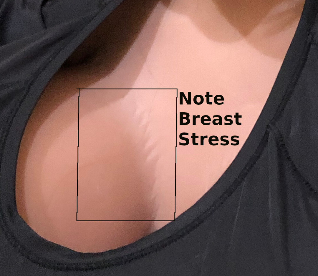Breast_Stress(crop).jpg
