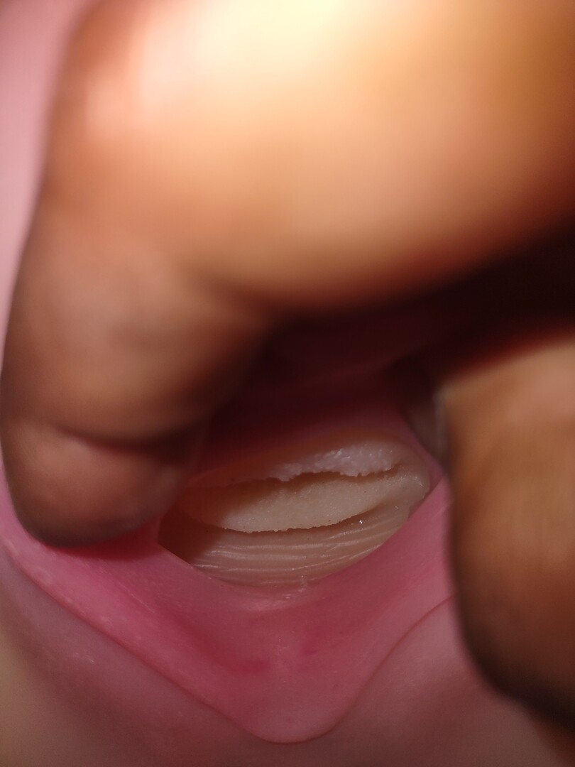 Texture inside vagina
