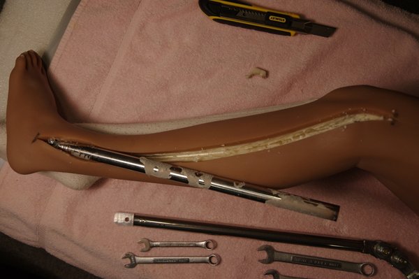 Lila Knee Repair (10).JPG
