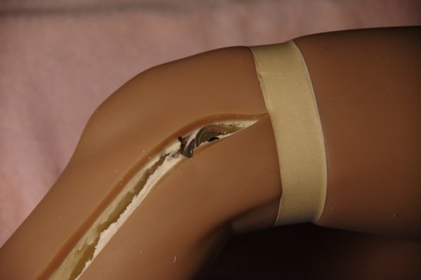 Lila Knee Repair (33).JPG