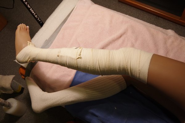 Lila Knee Repair (47).JPG