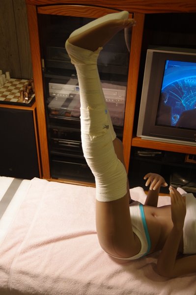 Lila Knee Repair (50).JPG