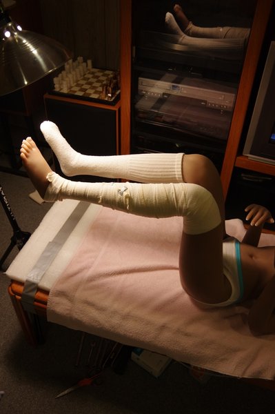 Lila Knee Repair (51).JPG