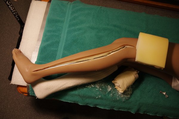 Lila Knee Repair (66).JPG