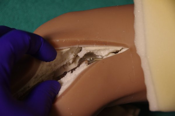 Lila Knee Repair (67).JPG