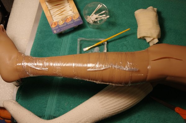 Lila Knee Repair (91).JPG