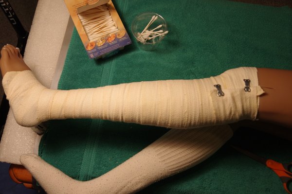 Lila Knee Repair (92).JPG