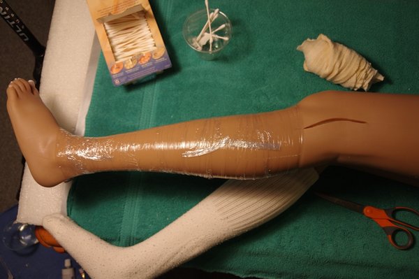 Lila Knee Repair (93).JPG