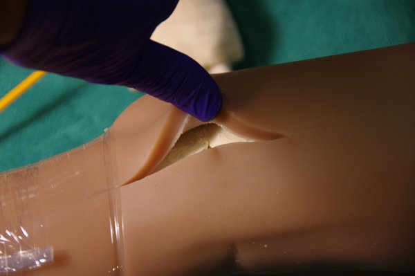 Lila Knee Repair (96).JPG