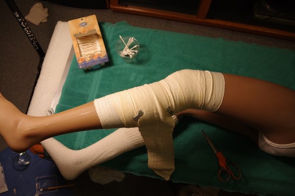 Lila Knee Repair (98).JPG