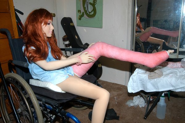 Yep!  Shelby has a broken leg!